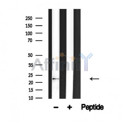 SAR1A Antibody - Western blot analysis of SAR1A in lysates of Jurkat , using SAR1A Antibody(AF4630).