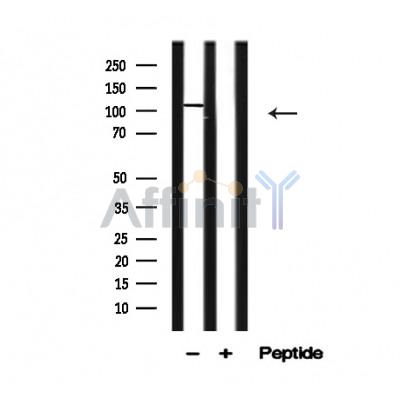 CYLD Antibody - Western blot analysis of CYLD in lysates of 293 , using CYLD Antibody(AF4637).