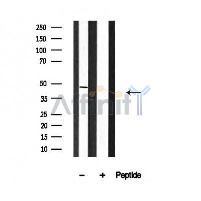 Thrombin Receptor Antibody - Western blot analysis of PAR1 in lysates of Platelet, using PAR1 Antibody(AF4644).
