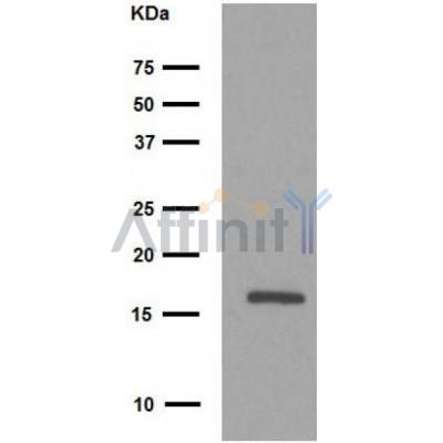 LC3B Antibody - Western blot analysis of LC3B Antibody expression in Rat liver tissue lysates.