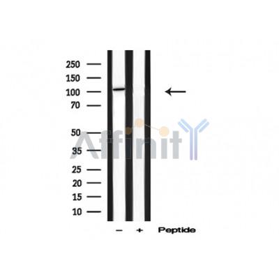CYLD Antibody - Western blot analysis of CYLD in lysates of HepG2 , using CYLD Antibody(AF4796).