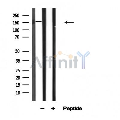 ROCK1 Antibody - Western blot analysis of ROCK1 in lysates of NIH-3T3, using ROCK1 Antibody(AF4604).