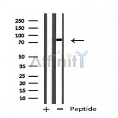 NUR77 Antibody - Western blot analysis of Nur77 in lysates of HepG2 , using Nur77 Antibody(AF4712).