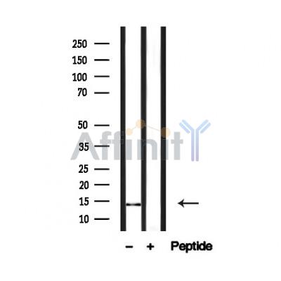 PEA15 Antibody - Western blot analysis of PEA-15 in lysates of A172 , using PEA-15 Antibody(AF4774).