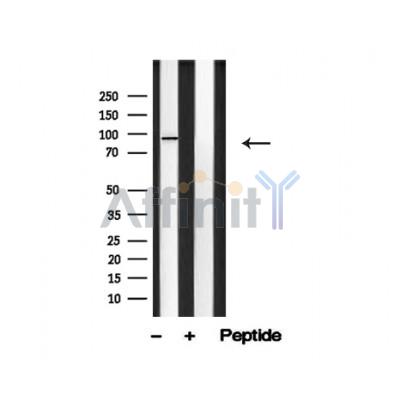 CDCP1 Antibody - Western blot analysis of CDCP1 in lysates of COLO205, using CDCP1 Antibody(AF4792).