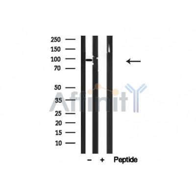 CDCP1 Antibody - Western blot analysis of CDCP1 in lysates of COLO205, using CDCP1 Antibody(AF4794).