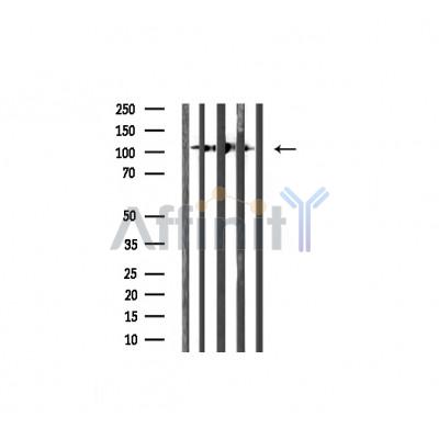 Collagen I Antibody - Western blot analysis of extracts from various samples,using Collagen I Antibody.