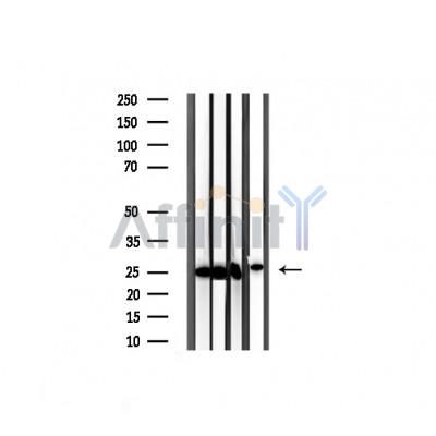 TIMP4 Antibody - Western blot analysis of extracts from various samples, using TIMP4 Antibody.