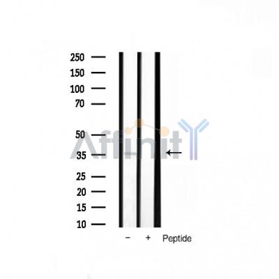 TNF alpha Antibody - Western blot analysis of extracts from rat brain, using TNFA Antibody.