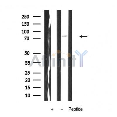 TORC2 Antibody - Western blot analysis of TORC2 antibody expression in A431 cells lysates.