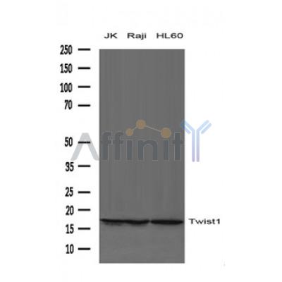 Twist1 Antibody - Western blot analysis of extracts from JK, Raji and HL-60 cells using Twist1 Antibody.