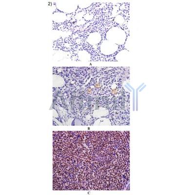 Twist1 Antibody -  Immunohistochemical staining for Twist1 in representative tissue samples.