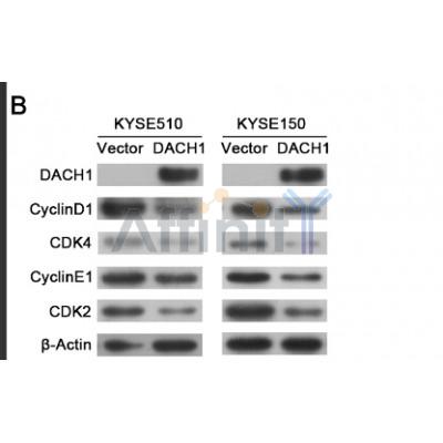 CDK4 Antibody - Western blot analysis of extracts from HUVEC cells using CDK4 Antibody.