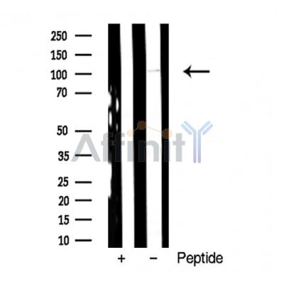 CD34 Antibody - Western blot analysis of extract from HUVEC cells and Hematopoietic Stem Cells from Umbilical Cord Blood using CD34 antibody.