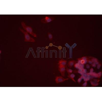EFNA1 Antibody - DF3117 staining Hela cells by IF/ICC.