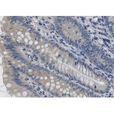 BMP2 Antibody - AF5163 at 1/100 staining human small intestine tissue sections by IHC-P.