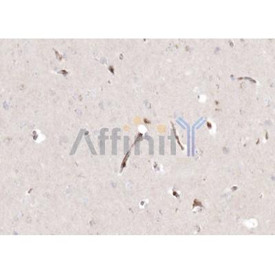 ABCG2 Antibody - AF5177 at 1/100 staining human brain tissue sections by IHC-P.