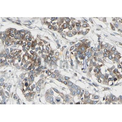 ACE1 Antibody - AF5197 at 1/100 staining human lung tissue sections by IHC-P.