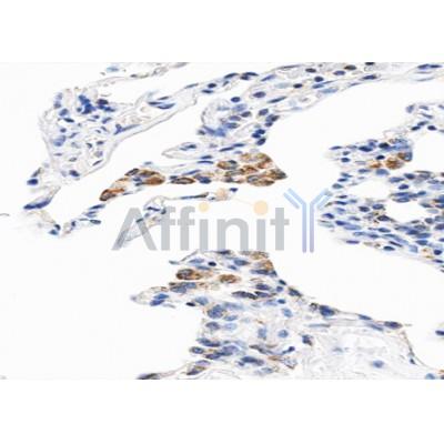 CYB5 Antibody - AF5273 at 1/100 staining human Lung tissue sections by IHC-P.