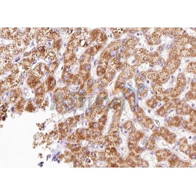 CXCR4 Antibody - AF5279 at 1/100 staining human liver tissue sections by IHC-P.