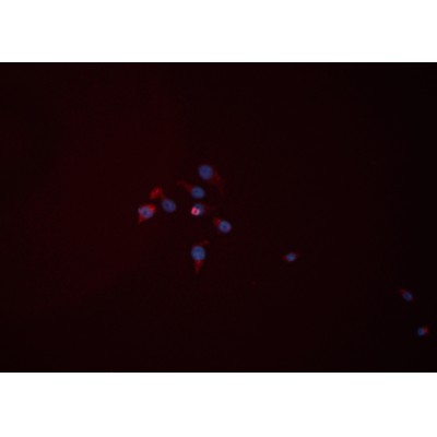 Hexokinase II Antibody - DF6176 staining HEPG2 cells by ICC/IF.