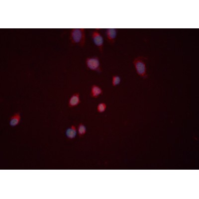 CYR61/CCN1 Antibody - DF6250 staining HeLa cells by ICC/IF.