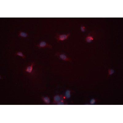 TNNT2 Antibody - DF6261 staining HeLa cells by ICC/IF.