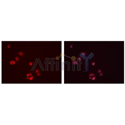 IGFBP7 Antibody - DF7131 staining Hela cells by IF/ICC.
