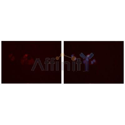 MMP10 Antibody - DF7152 staining Hela cells by IF/ICC.