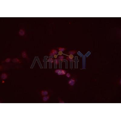 TRIM63 Antibody - DF7187 staining Hela cells by IF/ICC.