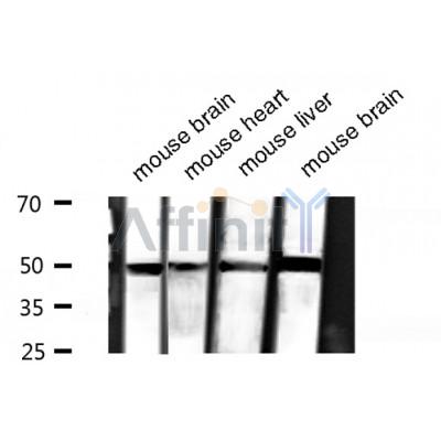 Tubulin alpha Antibody - Western blot analysis of Tubulin alpha expression in various sample.