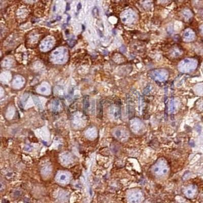 Tubulin alpha Antibody - AF7010 at 1/100 staining human breast  tissue by IHC-P.