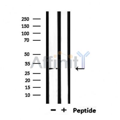 TSSK6 Antibody - Western blot analysis of extracts from mouse liver, using TSSK6 Antibody.