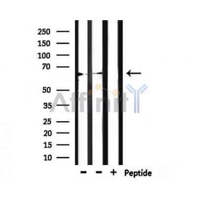 LINGO2 Antibody - Western blot analysis of extracts from mouse liver,mouse lung, using LINGO2 Antibody.