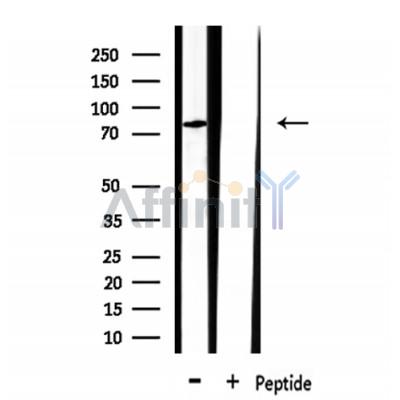 CLCN3 Antibody - Western blot analysis of extracts from rat brain, using CLCN3 Antibody.