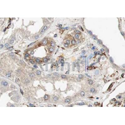 AQP6 Antibody - DF9223 at 1/100 staining human kidney tissue sections by IHC-P.