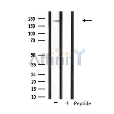 NAV1 Antibody - Western blot analysis of extracts from mouse brain, using NAV1 Antibody.