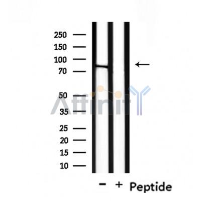 NOL11 Antibody - Western blot analysis of extracts from mouse brain, using NOL11 Antibody.