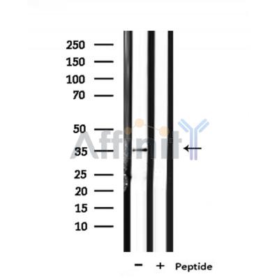OR6N1 Antibody - Western blot analysis of extracts from rat brain, using OR6N1 Antibody.
