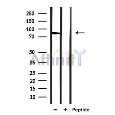 SLC6A17 Antibody - Western blot analysis of extracts from rat brain, using SLC6A17 Antibody.