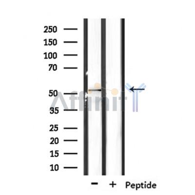 RASGEF1C Antibody - Western blot analysis of extracts from mouse liver, using RASGEF1C Antibody.