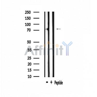 A-Myb Antibody - Western blot analysis of extracts from mouse muscle, using A-Myb Antibody.