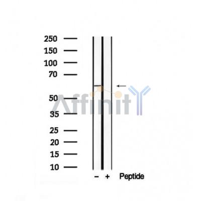 Phospho-SQSTM1/p62 (Ser28) Antibody - Western blot analysis of extracts from Hela, using Phospho-P62/SQSTM1（S28）Antibody.