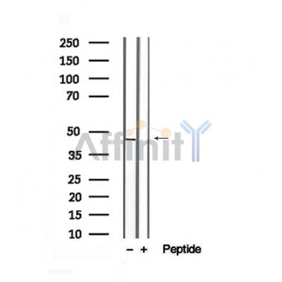 Phospho-CKB (Ser199) Antibody - Western blot analysis of extracts from Jurkat, using Phospho-CKB(S199) Antibody.