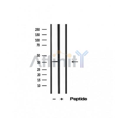 IKB beta Antibody - Western blot analysis of extracts from Hela treated with TNF-a, using IkappaB-beta Antibody.