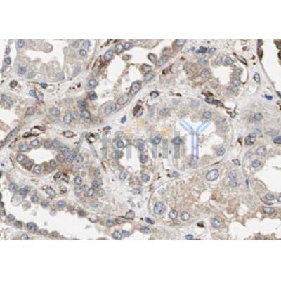 GADD34 Antibody - DF12009 at 1/100 staining human kidney tissue sections by IHC-P.
