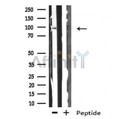 GADD34 Antibody - Western blot analysis on HeLa cells lysates using GADD34 antibody.