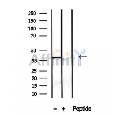 PRSS8 Antibody - Western blot analysis of extracts from A2780 cells, using PRSS8 antibody.