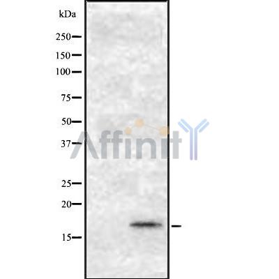 Osteocalcin Antibody - Western blot analysis Osteocalcin using K562 whole cell lysates.