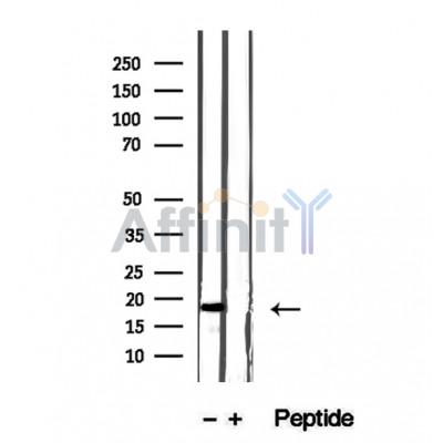 GMF-beta Antibody - Western blot analysis of extracts from fetal human brain tissue, using GMF-beta antibody.